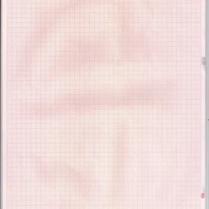 210mm X 295mm X 100Sheets ECG Paper Roll-12 ch Ecg