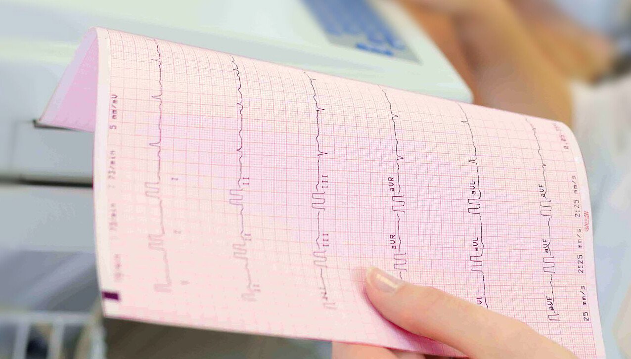 High-Quality ECG Paper Manufacturing: Why It Matters for Accurate Diagnosis
