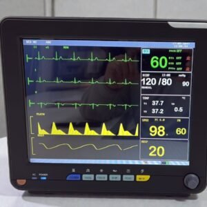 Cardiac Multipara Patient monitor-5 para